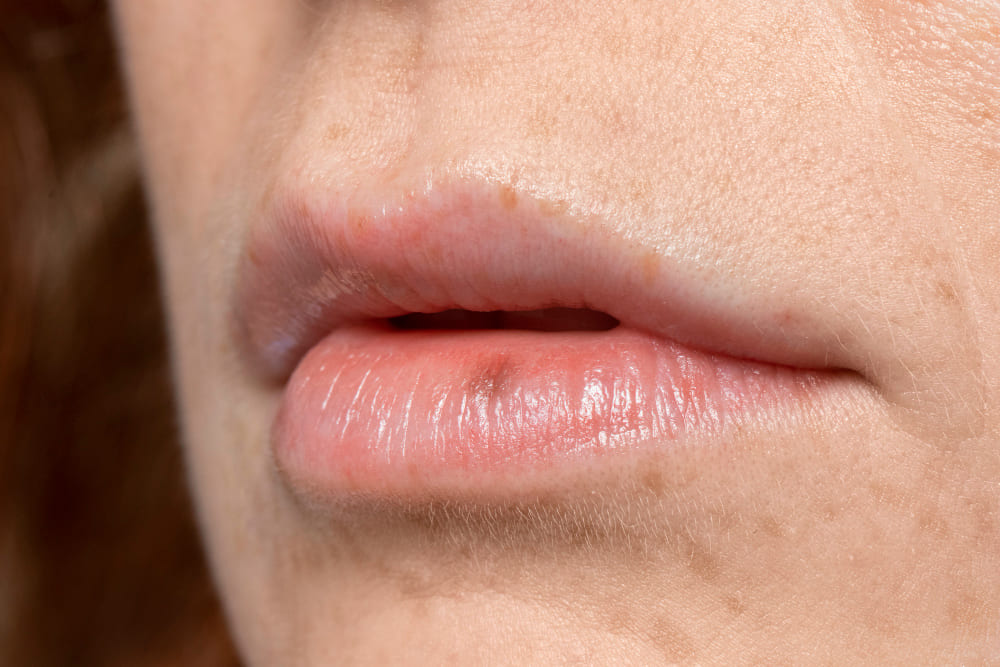 lips close up