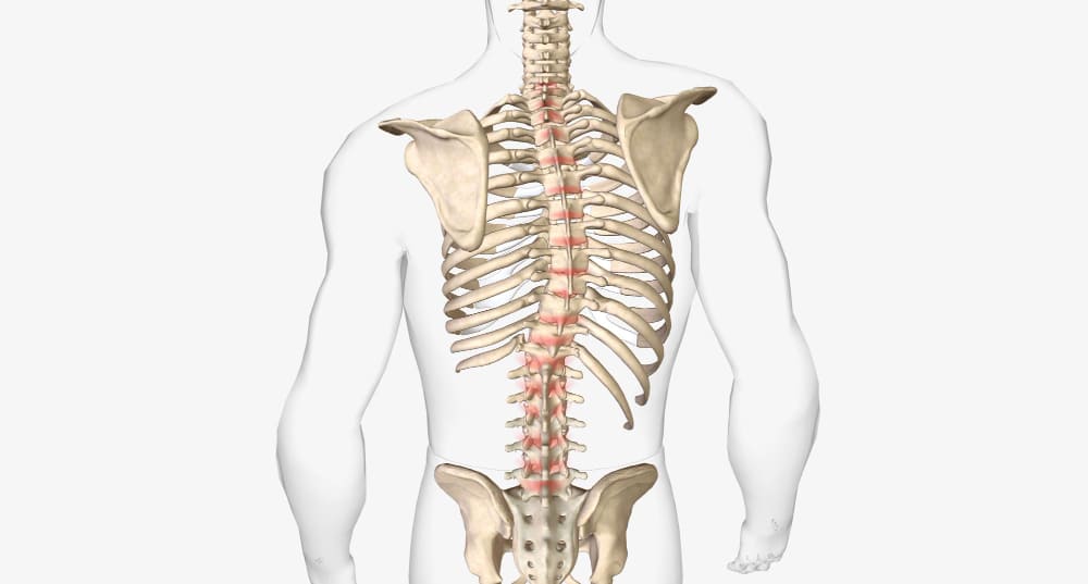 spinal scoliosis