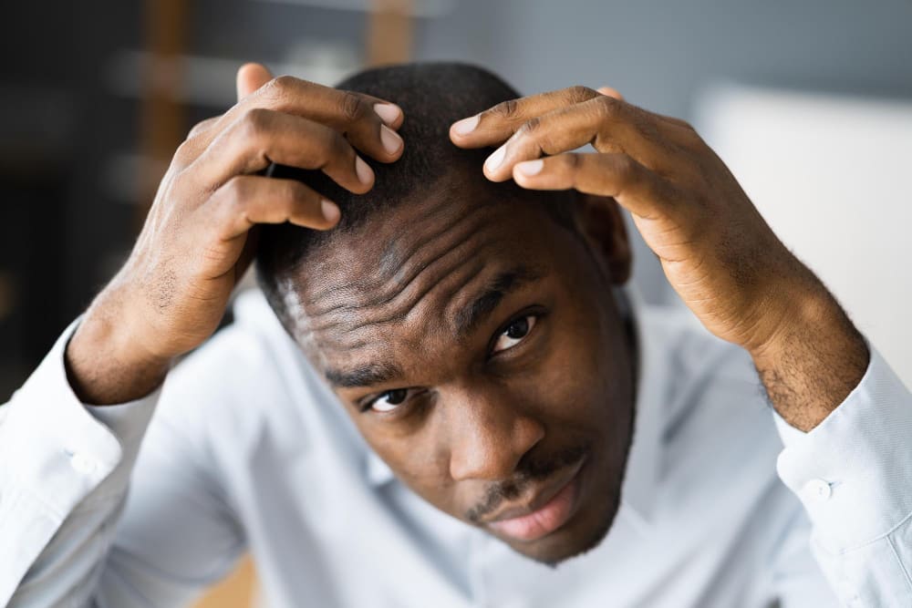 Man with scalp pain