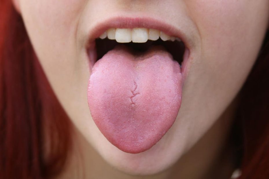Black Spot on Tongue Spiritual Meaning: Am I Tagged?